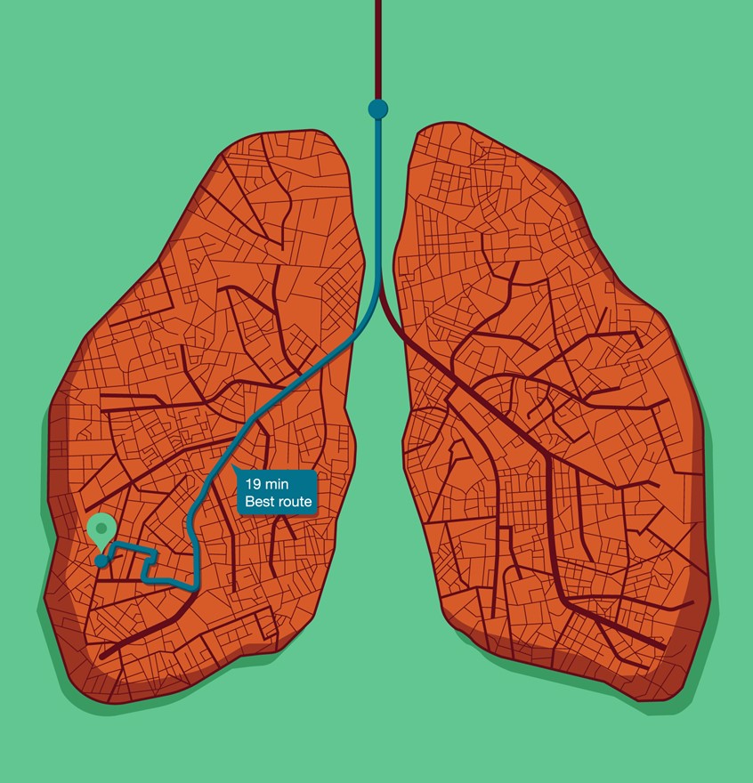 illustration of Created for Case Notes magazine, the illustration highlights how Ion facilitates clinicians to navigate the patients airways, and collect samples by creating a roadmap of the lungs, highlighting the lung nodule(s) selected for biopsy.
roadmap, healthcare, health, medical, lung, lungs, organ, biopsy, cancer, research, technology, robot, robotic, biology, conceptual, navigation