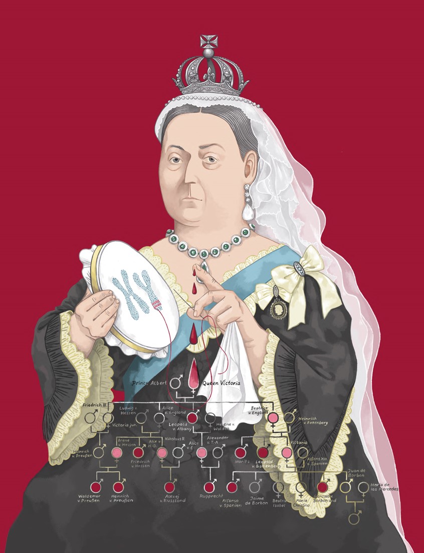 illustration of Portrait of Queen Victoria for an Article about the diseases of the royals. She was carrier of the hemophilia gene ...
tree, blood, disease, illness, genetics, royals, majestic, drop, family, noblesse, sad,