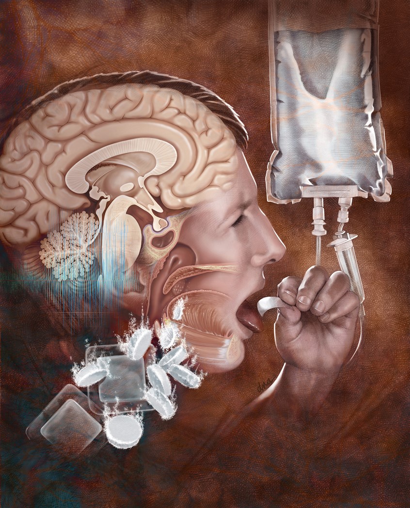 illustration of Illustration showing various methods of nausea and emesis control from chemo and radiation treatment. people, pencils, medical, patient education, treatments, medication, chemotherapy, pills, bubbles, brain, hands, anatomy, healthcare