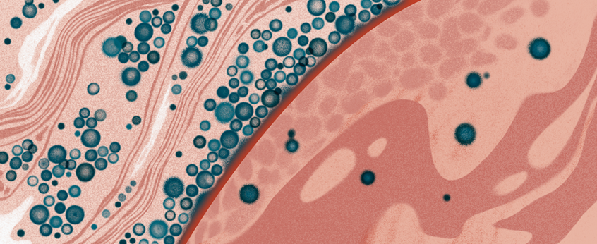 illustration of Illustration for Omnia Magazine 2022 Fall / Winter Issue.
'Cancer Cells Selectively Use ‘Drones’ to Keep T Cells from Infiltrating Tumors'
AD: Lusi Klimenko