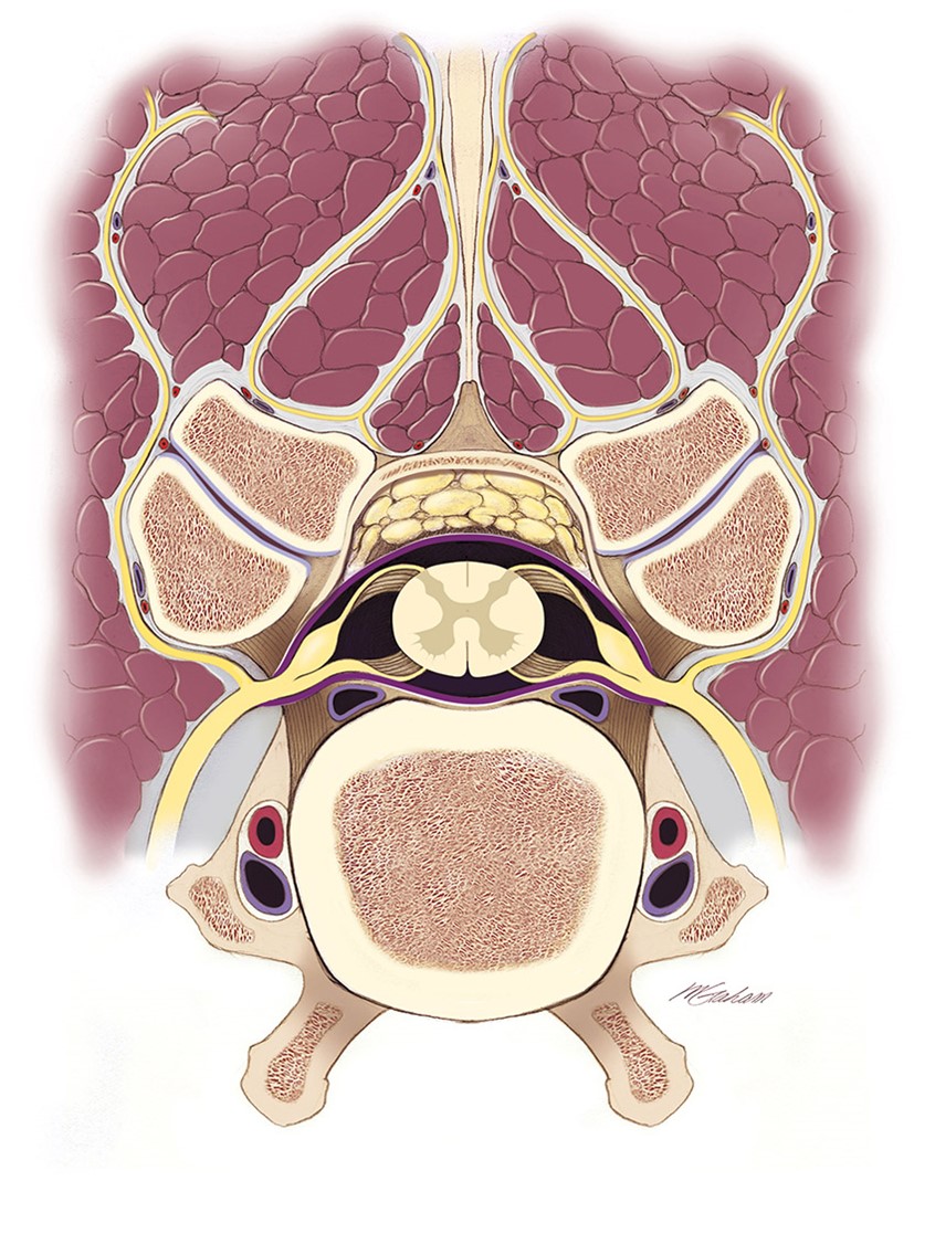 illustration of This illustrations shows a cross-section of a cervical vertebrae and spinal cord in the horse. Spinal nerves and branching rami are seen as well as dorsal root ganglia.