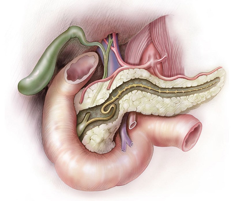 illustration of This illustration shows the pancreas with a section removed to reveal the duct within. The illustration also shows the surrounding anatomy; the duodenum, gall bladder, portal vien, celiac trunk and its branches.