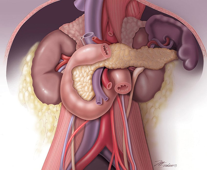 illustration of The parietal peritoneum has been removed from the posterior abdominal wall revealing the organs found behind this layer. These organs are; kidneys, pancreas, duodenum, abdominal aorta and vena cava.