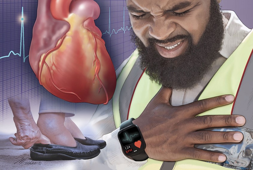 illustration of The main figure in this composition is having chest pain. Also illustrated are the swollen feet of an elderly woman trying to push her feet into a pair of shoes. A depiction of the anterior heart is seen in the upper left with a EKG in the background.