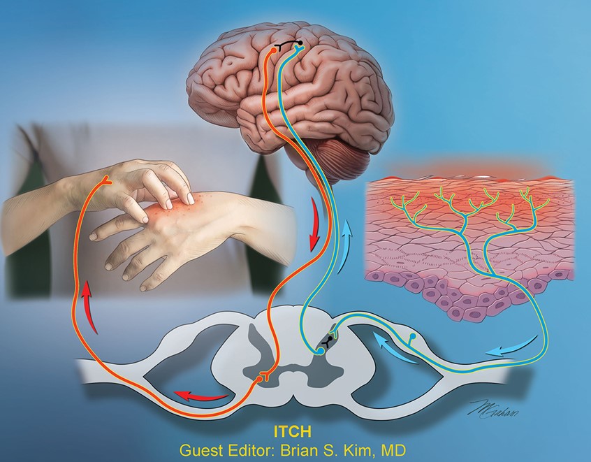 illustration of This illustration depicts the afferent and efferent pathways of the itch sensation. The image includes a section of skin, the brain, hands, and a cross section of the spinal cord and its branching rami.