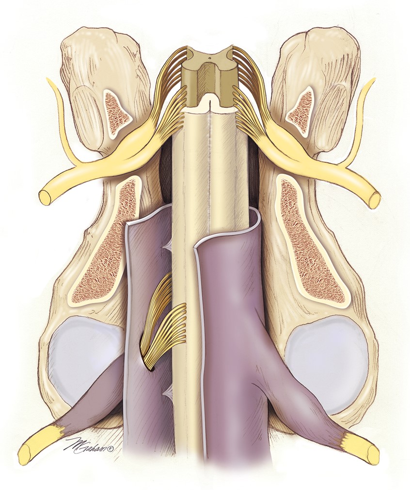 illustration of This illustration demonstrates the components of the equine spinal cord within the cervical region of the spine. Contained in the image are the sectioned vertebra, the dura mater, dorsal and ventral roots of the spinal nerves, dorsal root ganglion and indicated grey and white matter of the spinal cord.